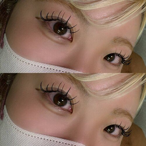 大橋が掲載した施術写真
